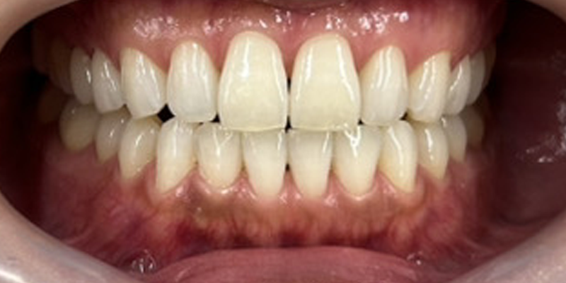 症例_7ビフォー画像