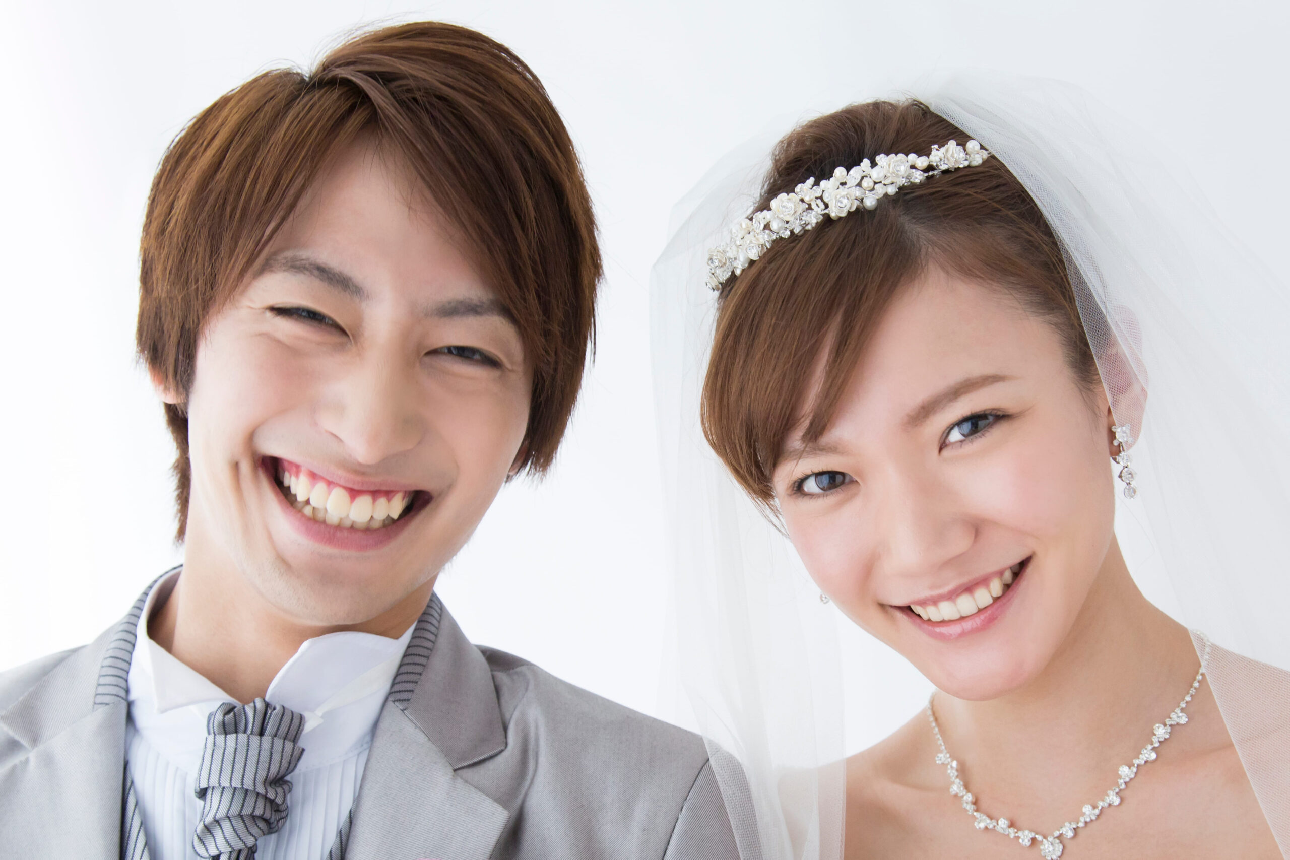 心斎橋　結婚式前のホワイトニングはいつから始めるべき？